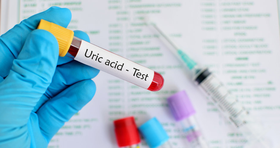 Uric Acid